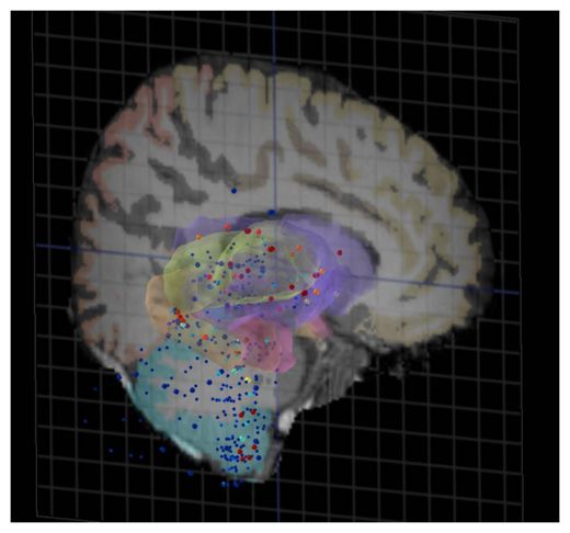 Click to enlarge Brain Atlas
