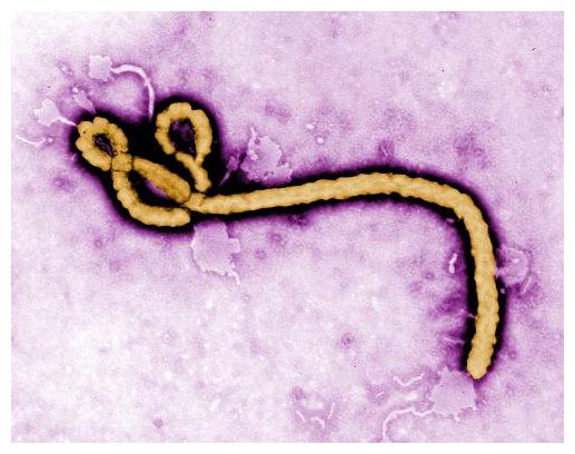 Click to enlarge Pathogens
