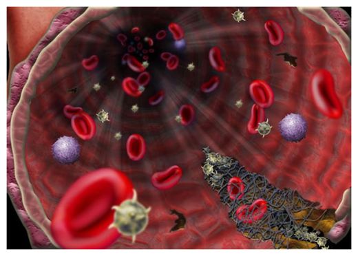 Click to enlarge Vel Blood Type