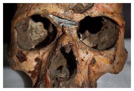 Click to enlarge Harappa Skull