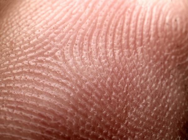 Click to enlarge Human Skin and Light