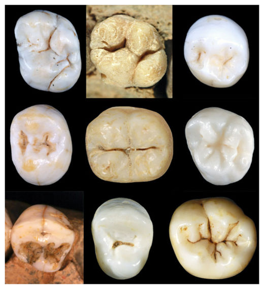 Neanderthals Teeth