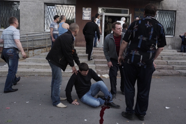 Wounded civilian ukraine