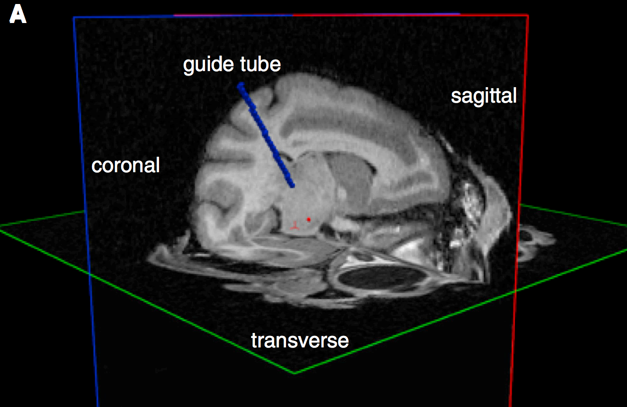 Click to enlarge Electrodes