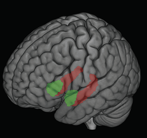 stress effect on brain