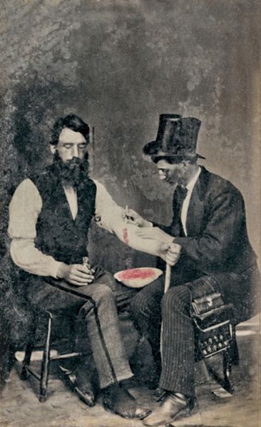 bloodletting, 2 guys