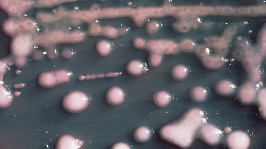  CRE bacteria