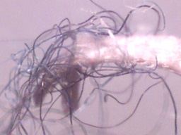 Morgellons Fiber