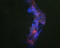 Autofluorescent Morgellons Fiber