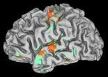 mri