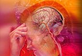 Click to enlarge Headache