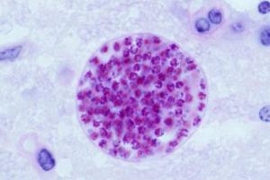 Click to enlarge Toxoplasma gondii