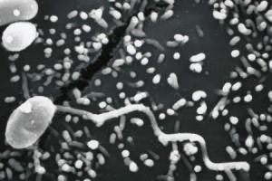 microsporidian spore 