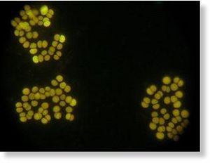 cyanobacteria 