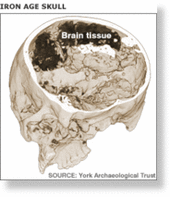 Oldest Brain