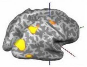 Brain