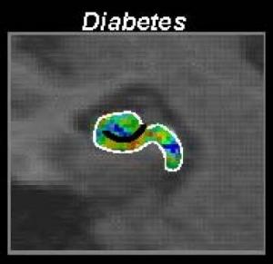 Cerebral blood volume (CBV) maps 