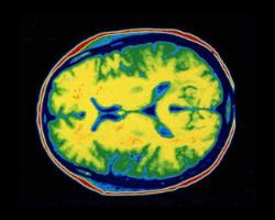 Click to enlarge brain
