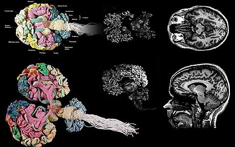 knitted brain