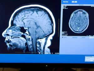 brain scan
