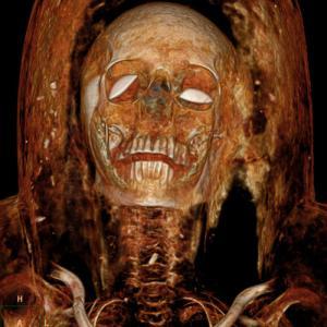 Egyptian mummy
