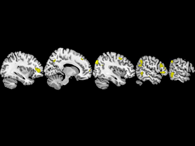 belief brain scans