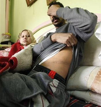 Click to enlarge MOL kidney