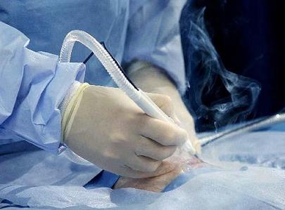 Click to enlarge laser surgery