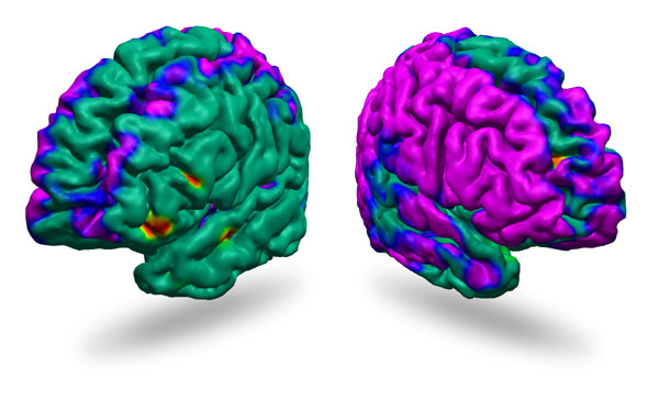 thinning cortex