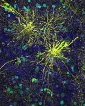 Click to enlarge Science Daily astrocytes