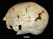 Click to enlarge Deformed Skull