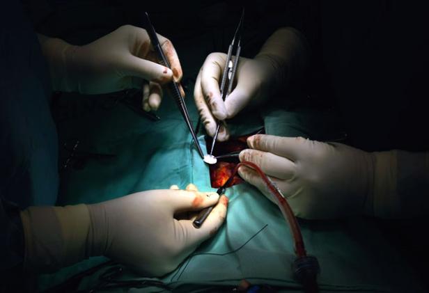 keyhole surgery