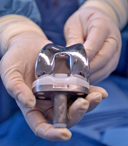 Artificial knee