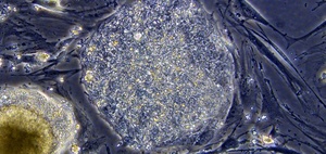 Embroyonic stem cell