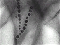 Click to enlarge Cancer nanomagnets