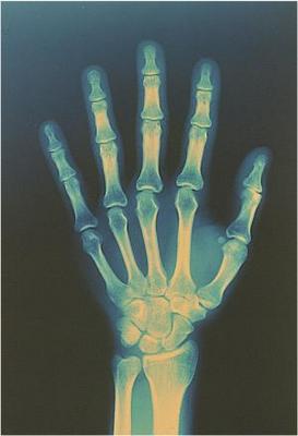 Hand X-Ray
