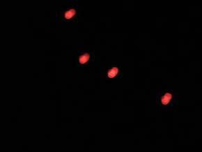 mystery lights