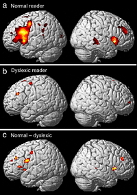 Reading brain