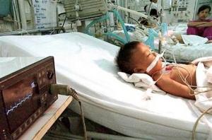 Click to enlarge boy affected by EV71