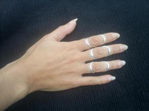 Silver ring splints