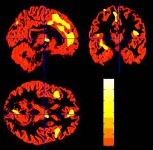 Magnetic resonance imaging of the brains 