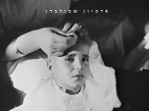 ringworm_child1