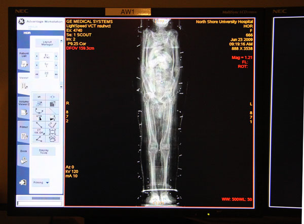 Brooklyn Mummies 5