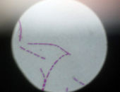stolen_anthrax_dublin