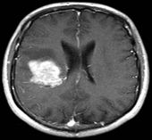 Click to enlarge Brain 2