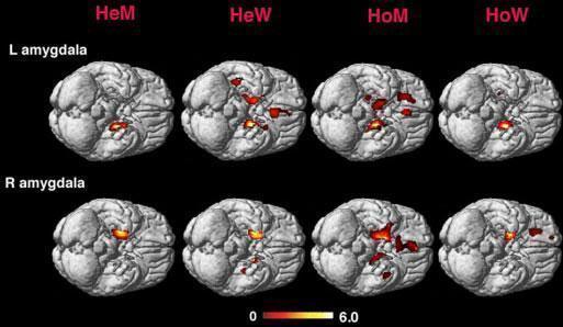 Click to enlarge Science Daily brains