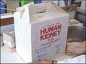 Click to enlarge kidney for transplant