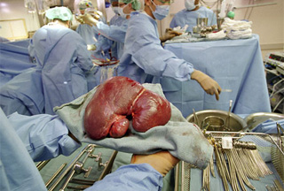 Click to enlarge organ trafficking