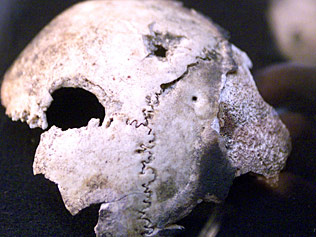 Click to enlarge Skull