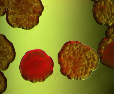 Bactera